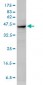 ACTA2 Antibody (monoclonal) (M02)